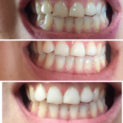 Teeth Plaque Remover Whitening Essence