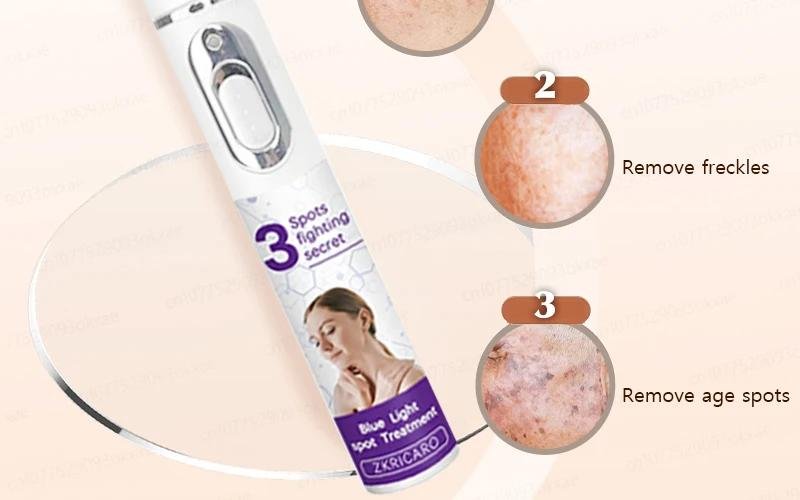 Age Spots Freckles Laser Remover